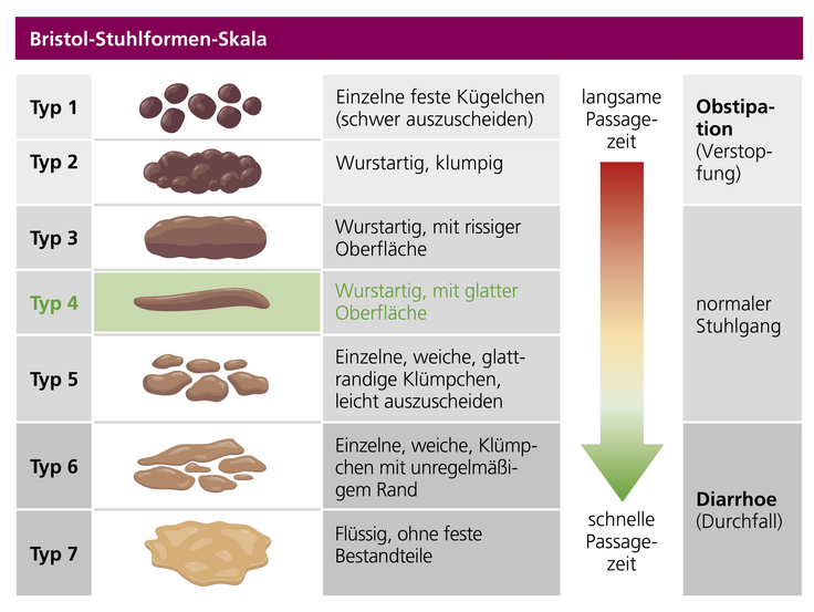 Hier sieht man eine Grafik der Bristol-Stuhlformen-Skala © sabelskaya / adobe.stock.com