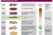 Hier sieht man eine Grafik der Bristol-Stuhlformen-Skala
